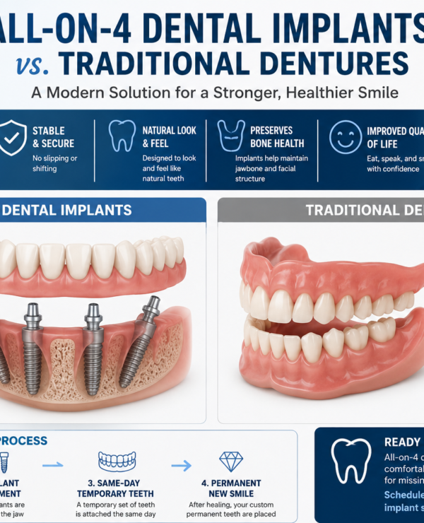All-on-4 dental implants